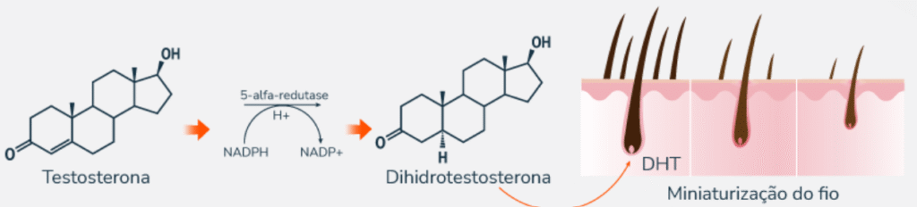 Como a testosterona se transforma em DHT causando queda de cabelo
